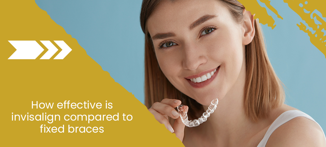 How Effective Is Invisalign Compared to Fixed Braces?