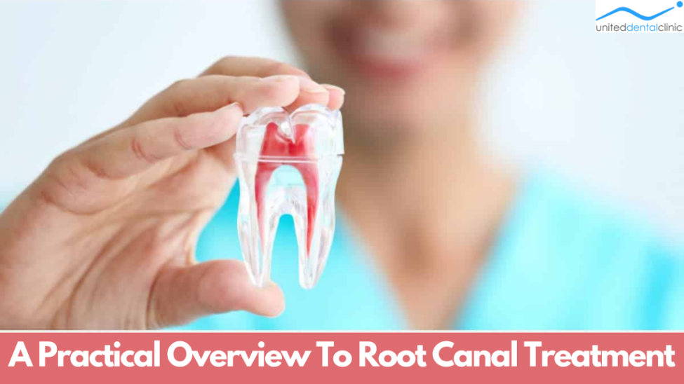 A Practical Overview To Root Canal Treatment